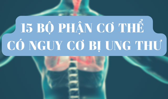 Các bộ phận như vú, gan , tiêu hóa, phần phụ… là những cơ quan trong cơ thể dễ mắc ung thư, nhất là do môi trường sống, chế độ sinh hoạt và mắc bệnh không được phát hiện và điều trị kịp thời. Ảnh minh họa