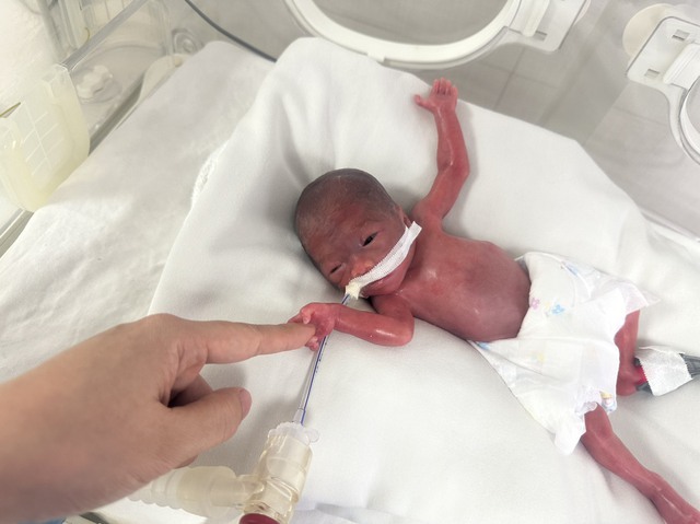93 ngày hồi sinh bé nhỏ gái sinh vô cùng non, chỉ nặng nề 550 gram- Hình ảnh 1.