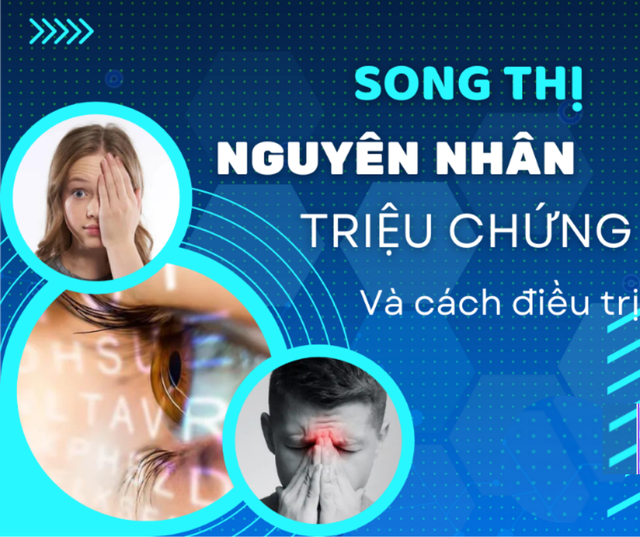 Song thị: Nguyên nhân, triệu chứng và cách cải thiện hiệu quả- Ảnh 1.