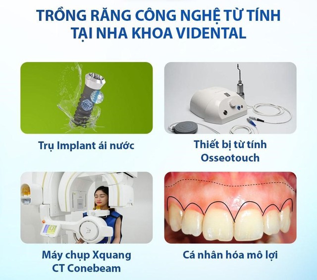 Hệ thống nha khoa uy tín tại Hà Nội được đánh giá cao trên review nha khoa- Ảnh 2.