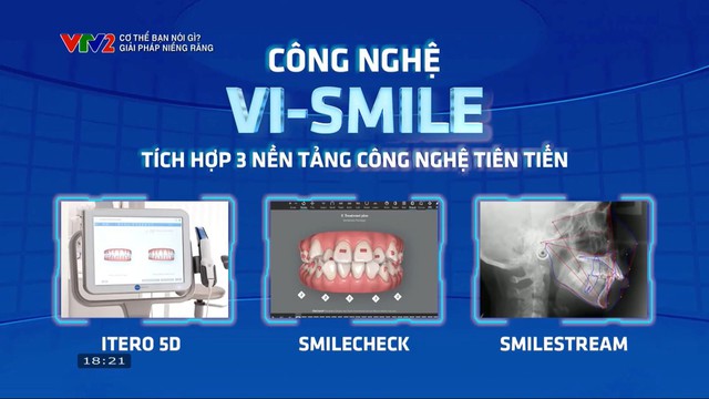 Nha khoa ViDental ứng dụng giải pháp niềng răng Vi Smile an toàn, hiệu quả- Ảnh 3.