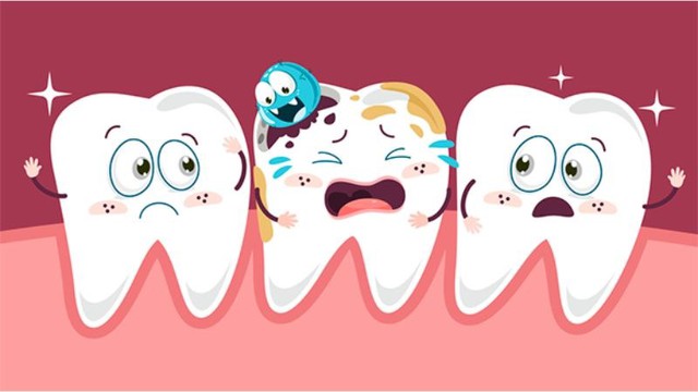 Sâu răng do sự kết hợp của nhiều yếu tố, bao gồm vi khuẩn trong miệng, ăn vặt thường xuyên, nhâm nhi đồ uống có đường và vệ sinh răng miệng kém.