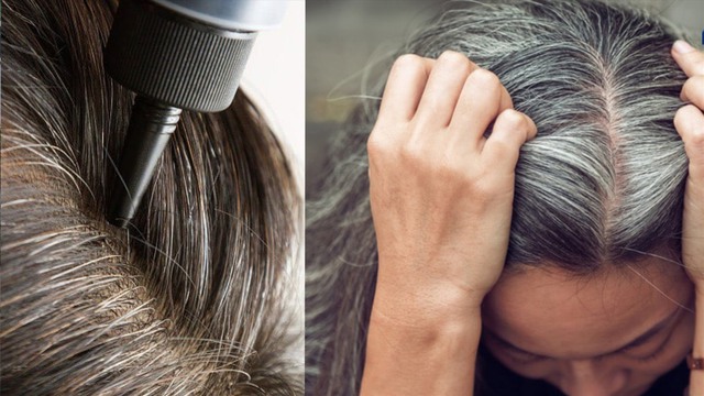 Thói quen nhổ tóc bạc, tóc sâu không làm giảm cảm giác ngứa do không giải quyết được căn nguyên gây ngứa mà còn làm tổn thương cho da đầu và nang tóc.