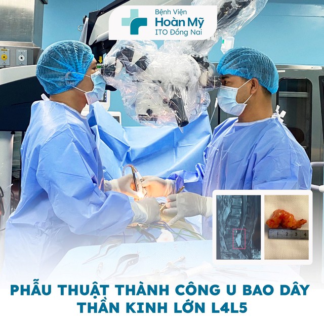 Bệnh viện Hoàn Mỹ ITO Đồng Nai thành công rực rỡ trong ca phẫu thuật U bao dây thần kinh lớn đoạn L4 L5- Ảnh 1.