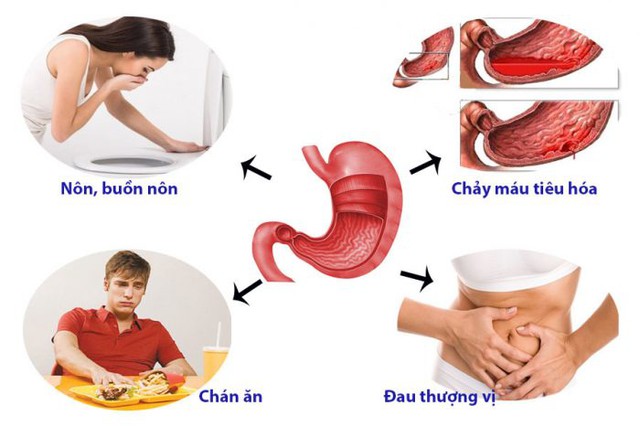 Viêm loét dạ dày có thể điều trị dứt điểm nếu được phát hiện sớm và được điều trị kịp thời. Ảnh minh hoạ