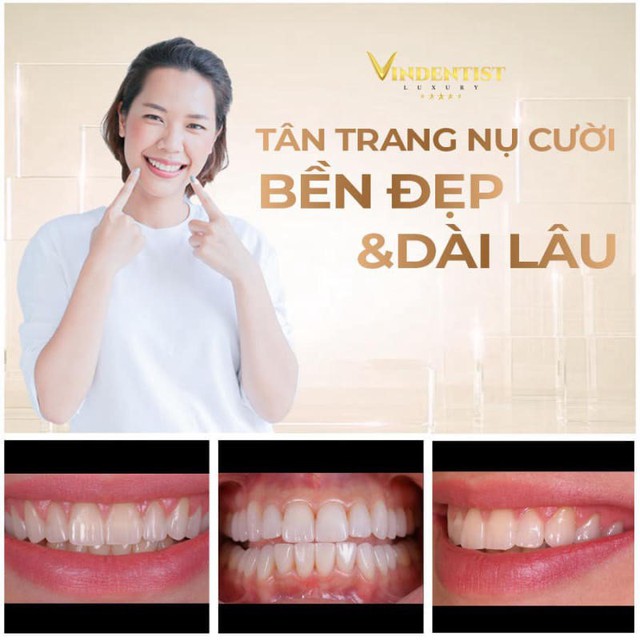 Nụ cười rạng ngời - Tự tin tỏa sáng cùng Nha khoa Thẩm mỹ VIN Dentist tại Đà Nẵng- Ảnh 2.