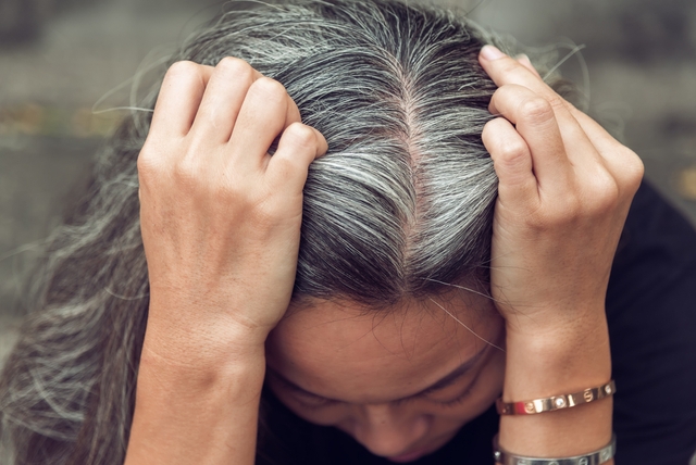 Cách giúp ngăn ngừa tóc bạc sớm hiệu quả- Ảnh 2.