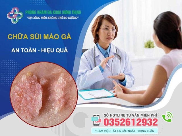 Sùi mào gà ở nữ giới: Nguyên nhân, dấu hiệu, cách chữa- Ảnh 1.