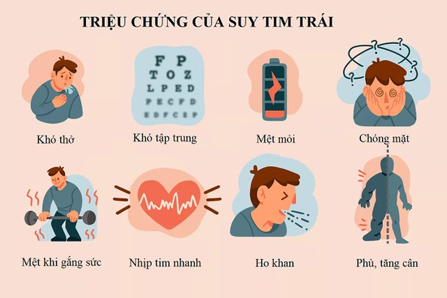 Suy tim trái: Nguyên nhân, triệu chứng, cách điều trị và phòng bệnh- Ảnh 3.