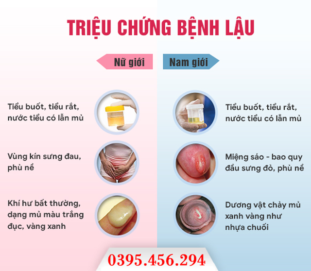 20 triệu chứng bệnh lậu ở nam, nữ giới thường gặp- Ảnh 1.