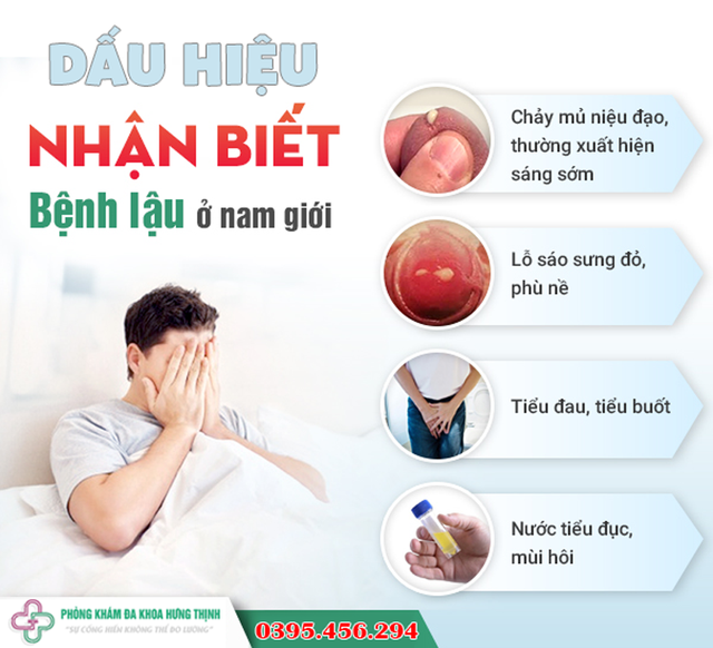 20 triệu chứng bệnh lậu ở nam, nữ giới thường gặp- Ảnh 2.