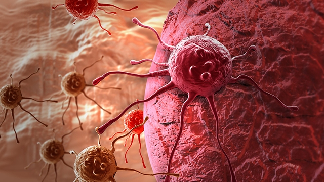 Có hơn 100 loại ung thư khác nhau. Ung thư thường được gọi tên theo cơ quan mà nó phát sinh.