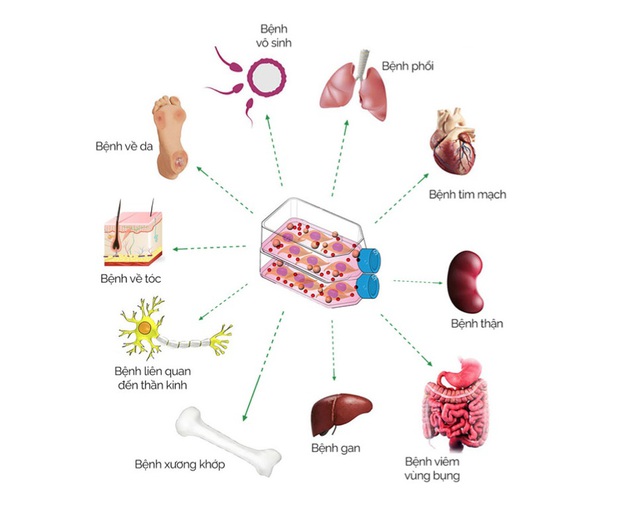 Ứng dụng điều trị với tế bào gốc từ Ngân hàng mô thuộc Bệnh viện Quốc tế DNA- Ảnh 2.