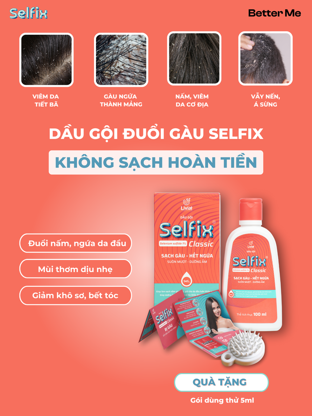 Da đầu gàu – đổi dầu gội chuyên sâu nào?- Ảnh 3.