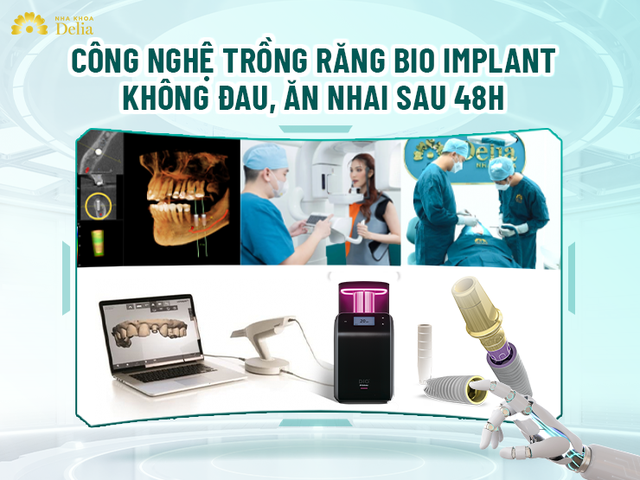 Trải nghiệm công nghệ trồng răng không đau với nha khoa Delia- Ảnh 1.