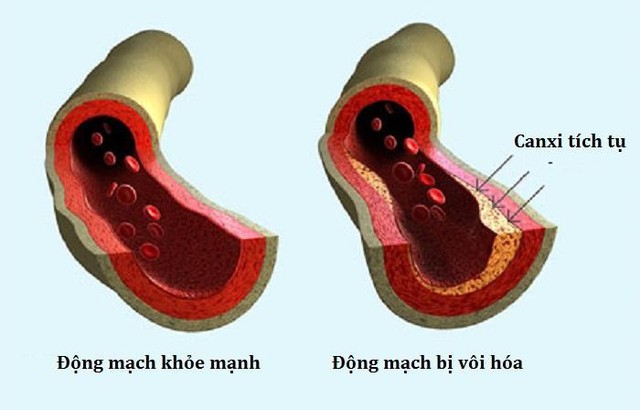 Tầm quan trọng của vitamin K2 đối với sức khỏe và sự phát triển của trẻ- Ảnh 2.