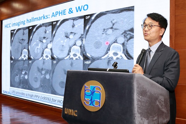 EOB-MRI giúp chẩn đoán sớm và chính xác ung thư biểu mô tế bào gan HCC- Ảnh 3.