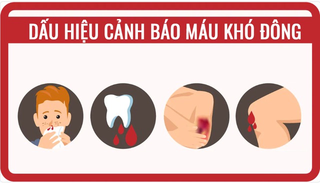 Những dấu hiệu cảnh báo máu khó đông bạn cần biết- Ảnh 1.