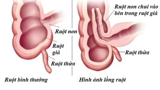 Câu hỏi liên quan đến bệnh lỵ amip đường ruột- Ảnh 3.