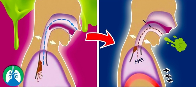 Bị ho có phải kiêng ăn thịt gà, tôm?- Ảnh 1.