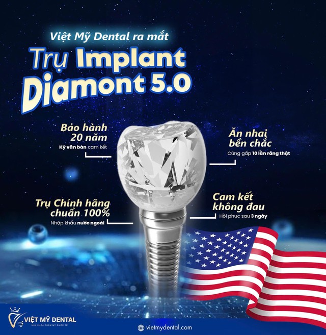 Việt Mỹ - Dịch vụ trồng răng công nghệ cao Implant, uy tín trong ngành- Ảnh 3.