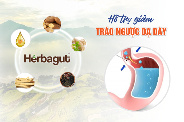 Herbagut – Chiết xuất từ 14 thảo dược tốt cho người bị trào ngược dạ dày- Ảnh 1.