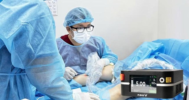 Suy giãn tĩnh mạch: nguy cơ tiềm ẩn sau đôi chân mỏi- Ảnh 3. Suy giãn tĩnh mạch: nguy cơ tiềm ẩn sau đôi chân mỏi- Ảnh 3.