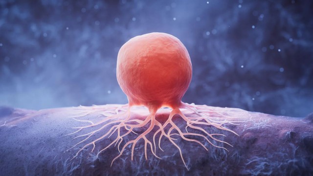 Giảm chất béo có thể 'bỏ đói' tế bào ung thư vú- Ảnh 1. Giảm chất béo có thể 'bỏ đói' tế bào ung thư vú- Ảnh 1.