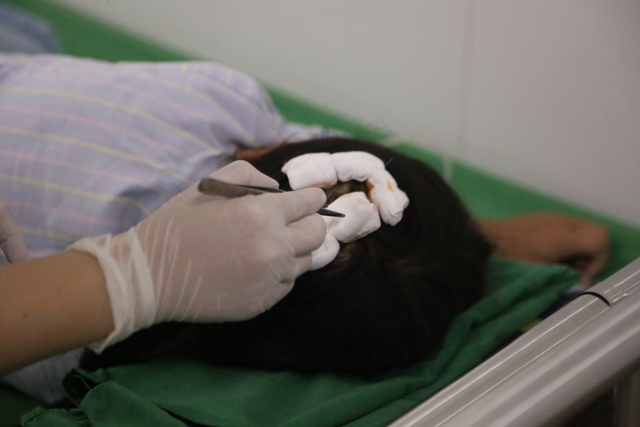 Bé gái nghi bị bố dượng bạo hành ở Hà Tĩnh phải khâu 7 mũi, có 3 vết thương ở đầu- Ảnh 2. Bé gái nghi bị bố dượng bạo hành ở Hà Tĩnh phải khâu 7 mũi, có 3 vết thương ở đầu- Ảnh 2.