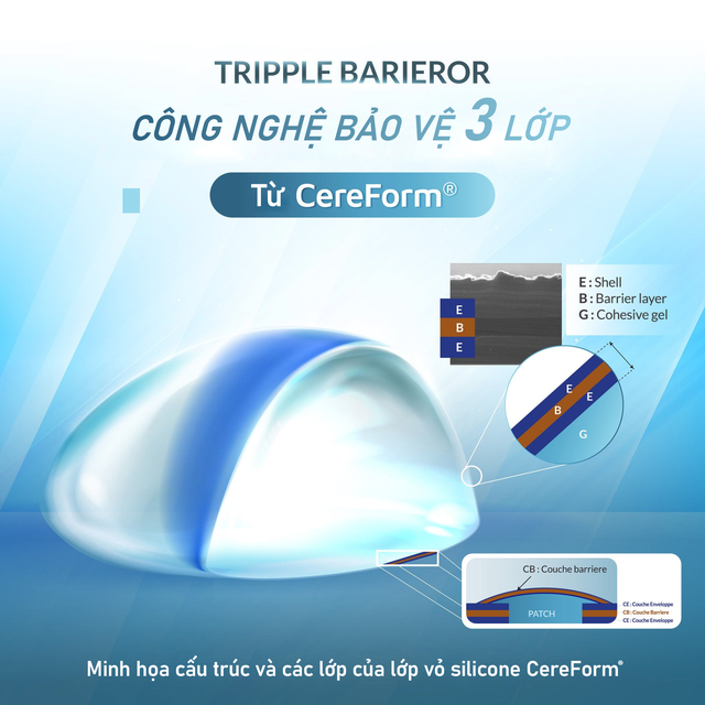 Túi ngực Cereform đạt chuẩn châu Âu chính thức phân phối tại Việt Nam- Ảnh 2.