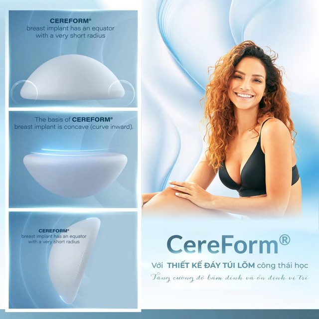 Túi ngực Cereform đạt chuẩn châu Âu chính thức phân phối tại Việt Nam- Ảnh 3.