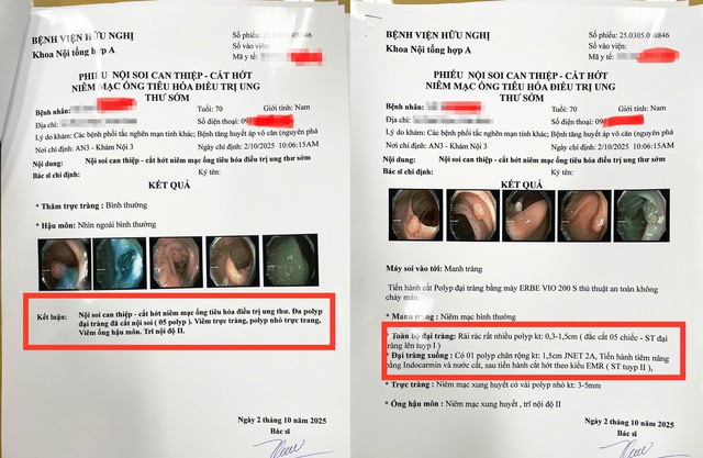 Vaccine ung thư: Hiểu đúng để không kỳ vọng sai.- Ảnh 1.