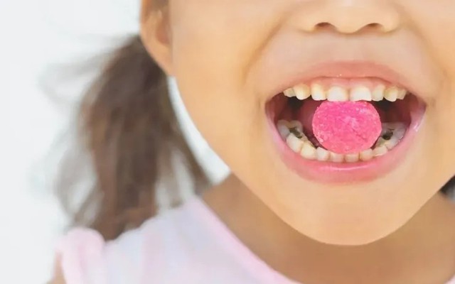 7 loại thực phẩm làm tăng nguy cơ sâu răng bạn nên biết để tránh- Ảnh 1.