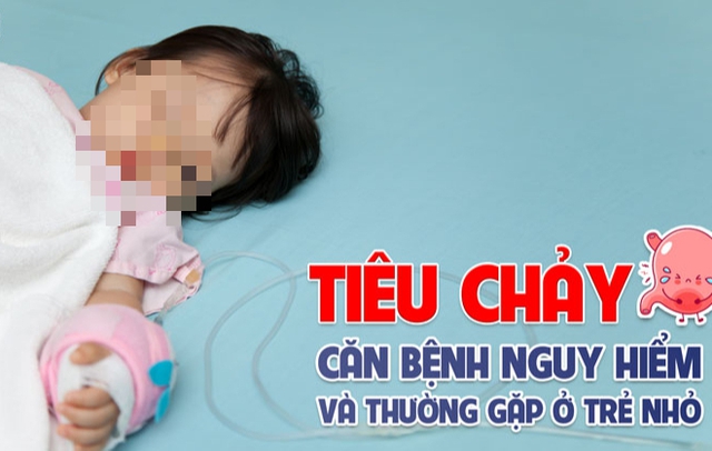Nhận biết tình trạng tiêu chảy cấp ở trẻ dưới 2 tuổi và các phương pháp điều trị - Ảnh 2. Nhận biết tình trạng tiêu chảy cấp ở trẻ dưới 2 tuổi và các phương pháp điều trị - Ảnh 2.