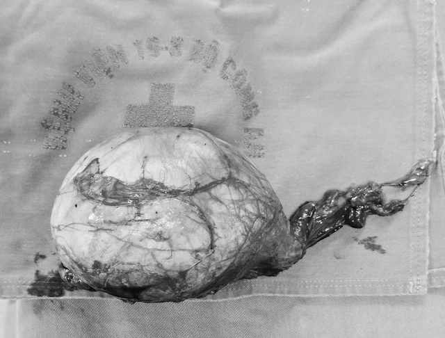 Cảnh báo từ ca ung thư tinh hoàn ở người trẻ: Đừng giấu bệnh vì xấu hổ- Ảnh 2.