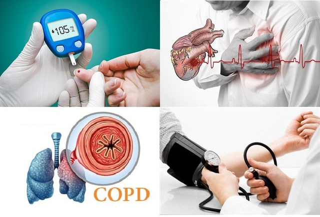 PGS.TS Nguyễn Xuân Ninh: Ăn uống khoa học là 'liều thuốc vàng' ngăn bệnh không lây nhiễm- Ảnh 1.