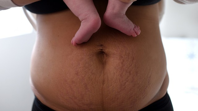 Các cột mốc hồi phục sức khỏe bà mẹ trong 40 ngày sau sinh- Ảnh 1. Các cột mốc hồi phục sức khỏe bà mẹ trong 40 ngày sau sinh- Ảnh 1.