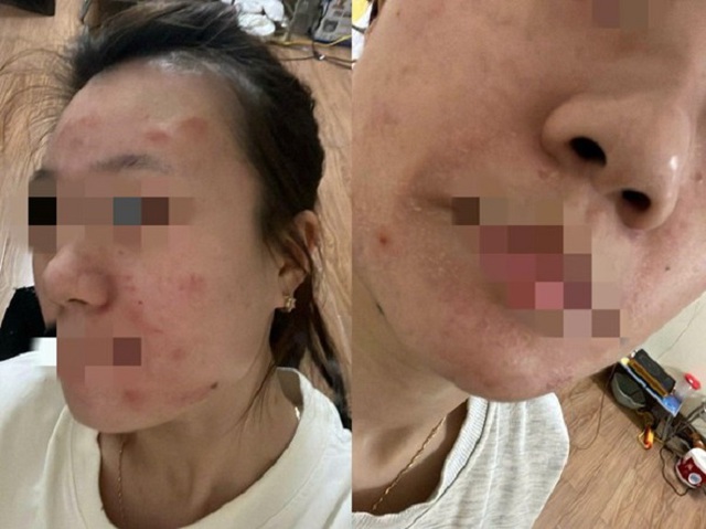 Đốt rác tự phát, nguyên nhân làm nghiêm trọng thêm ô nhiễm không khí- Ảnh 6.