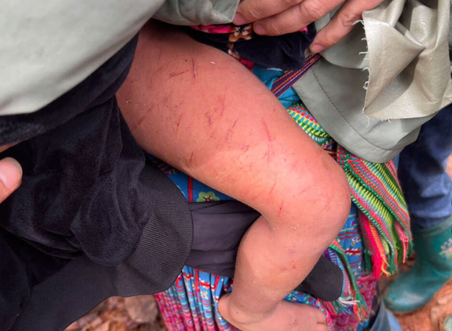 Đêm mưa rét kinh hoàng của bé 4 tuổi lạc trong rừng cao su- Ảnh 1.