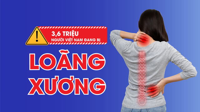 Loãng xương và gãy xương sau 40 tuổi: Nguy cơ âm thầm nhưng có thể phòng ngừa sớm- Ảnh 1.