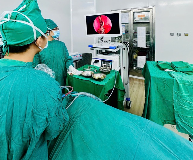 Bác sĩ lấy dị vật vôi hóa tồn tại nhiều năm trong mũi bệnh nhân- Ảnh 1.