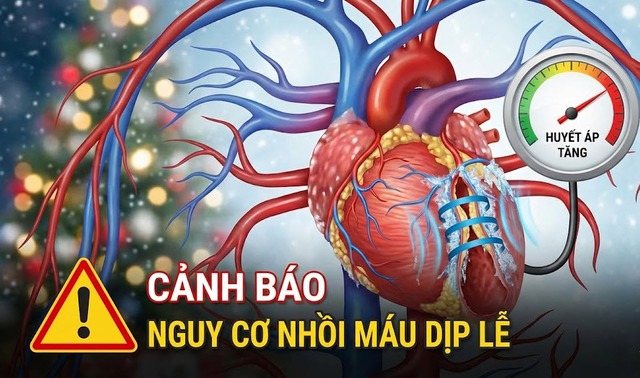 Nguy cơ nhồi máu cơ tim dịp lễ, cuối năm tăng mạnh- Ảnh 1.