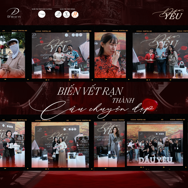 'Dấu Yêu': Chiến dịch nhân văn của D'Beauty chạm đến hàng nghìn phụ nữ Việt- Ảnh 2. 'Dấu Yêu': Chiến dịch nhân văn của D'Beauty chạm đến hàng nghìn phụ nữ Việt- Ảnh 2.