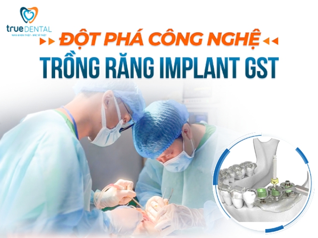 True Dental - Nha khoa chuyên sâu về cấy ghép Implant công nghệ cao- Ảnh 2.