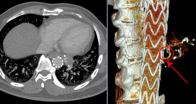 Siêu máy chụp CT hỗ trợ các bác sĩ phát hiện sớm ung thư, đột quỵ- Ảnh 3.