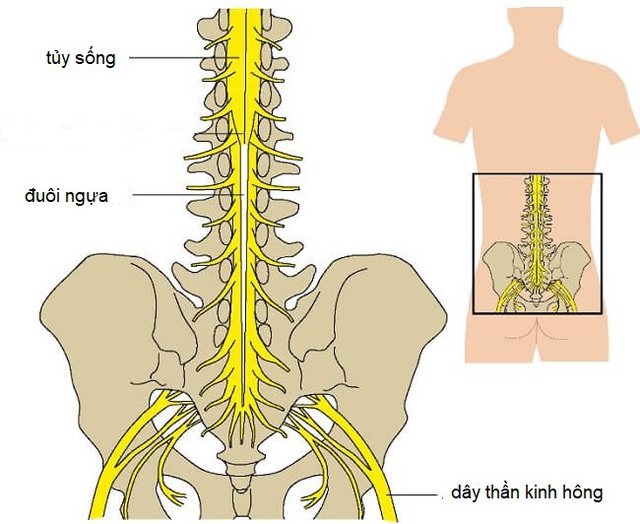 5 câu hỏi thường gặp khi mắc hội chứng đuôi ngựa- Ảnh 1.