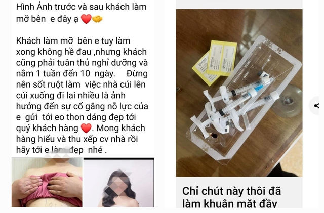 Méo miệng, hoại tử da bụng vì tin lời quảng cáo làm đẹp trên mạng xã hội- Ảnh 2.