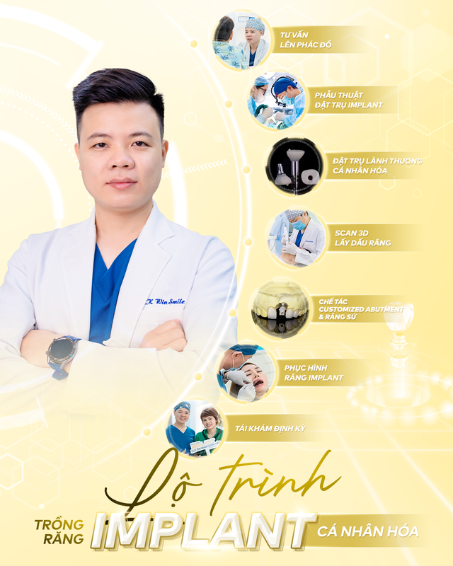 Quy trình trồng răng Implant tối ưu thời gian, hiệu quả tại Win Smile- Ảnh 1.