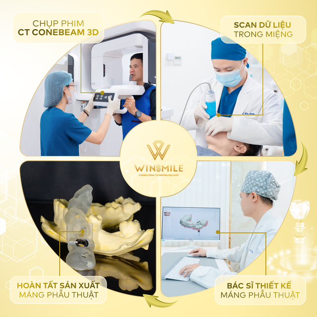 Quy trình trồng răng Implant tối ưu thời gian, hiệu quả tại Win Smile- Ảnh 2.