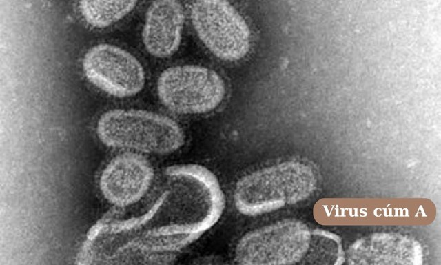 Cúm gia cầm có lây cho người không, cách ngăn ngừa dịch tiến triển- Ảnh 2.